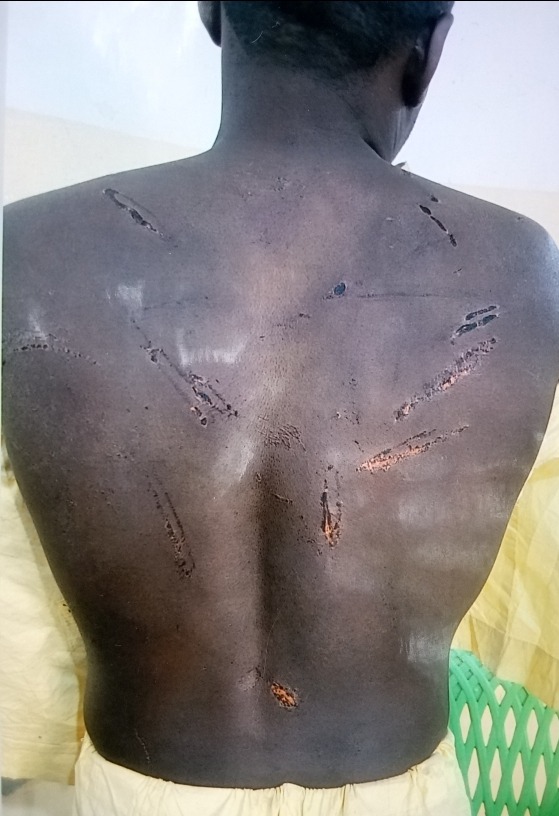 Man petitions Bauchi CP over alleged brutality by police officer